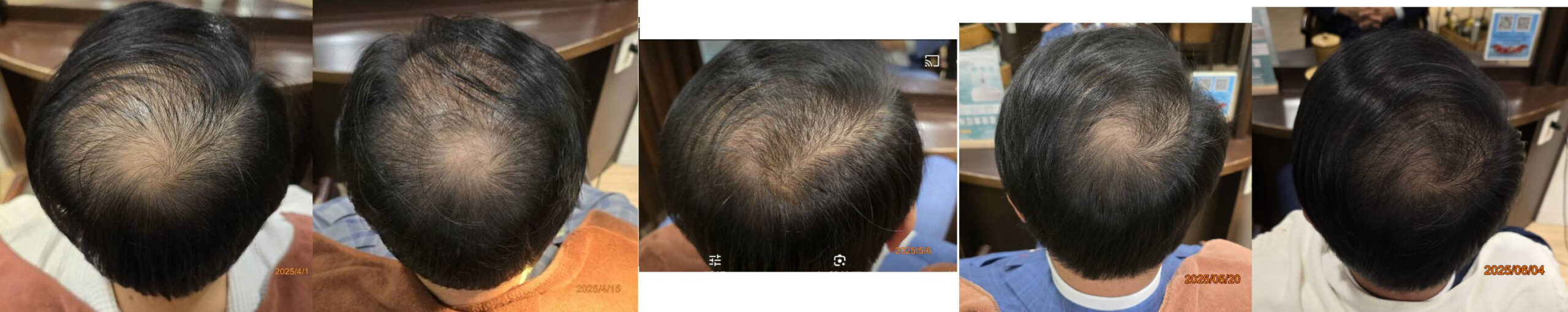 New Hair Regrowth Combo - Image 5