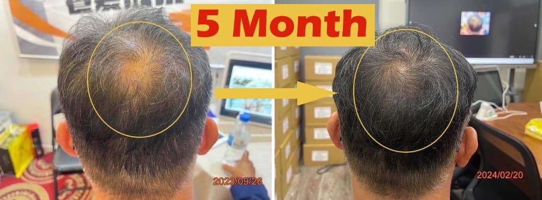 Hair Regrowth Combo - Image 6
