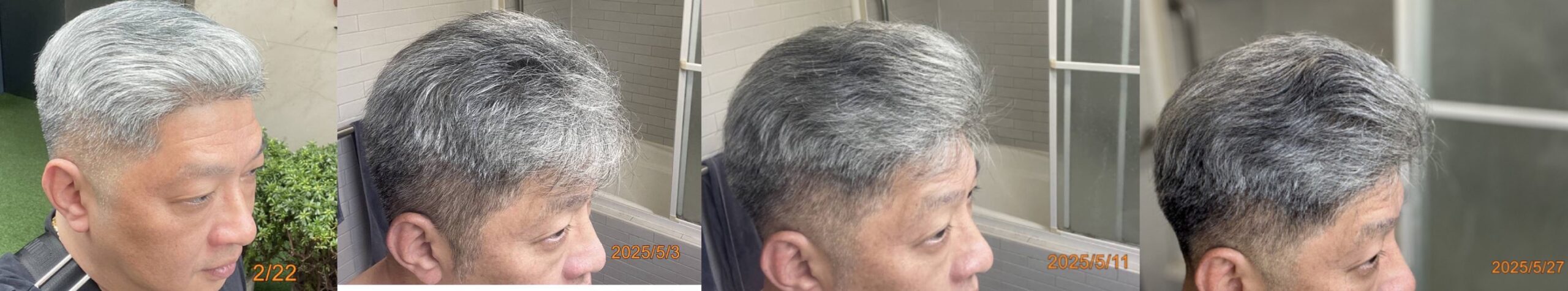 New Hair Regrowth Combo - Image 8