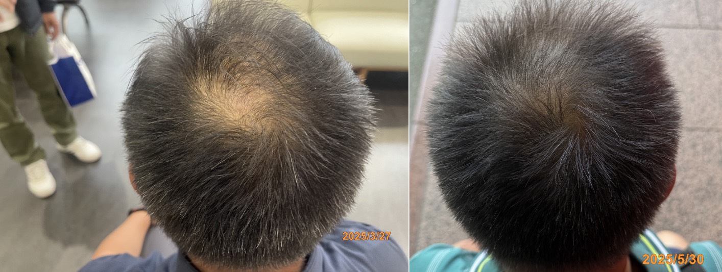 New Hair Regrowth Combo - Image 7