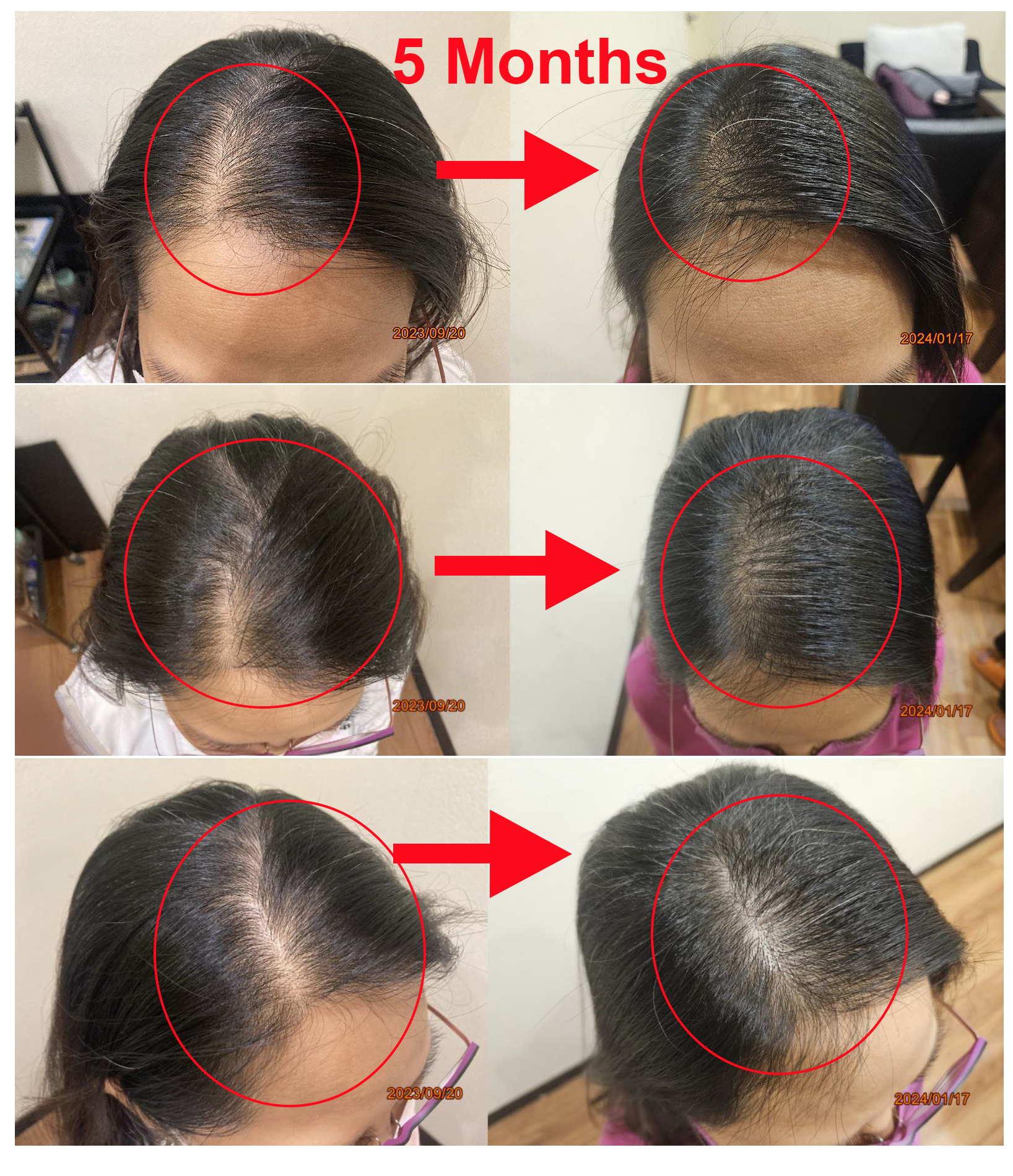 Hair Regrowth Combo - Image 5